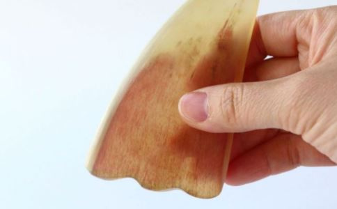 脸上长了黄褐斑 刮痧疗法能治疗