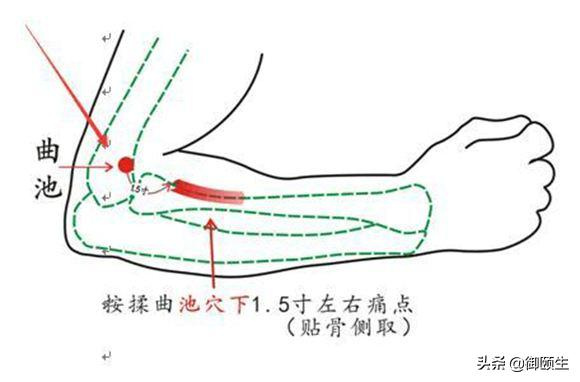 慢性咽炎说不出来的痛以下4招可轻松缓解