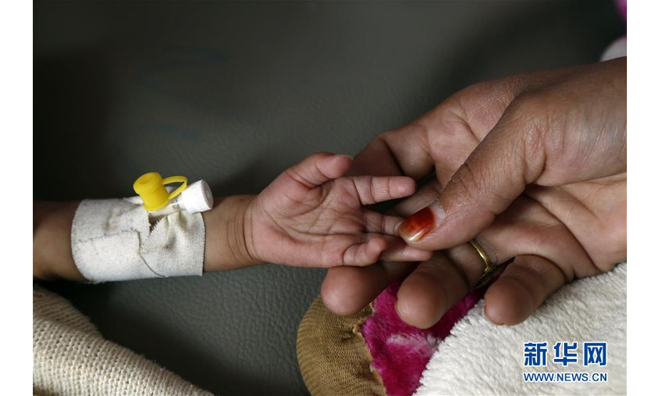 10月17日，在也门首都萨那一家医院，一名营养不良的儿童在接受治疗。

　　10月17日是国际消除贫困日，联合国将今年的主题确定为“共同行动，实现儿童家庭社区赋权，消除贫困”。 新华社发（穆罕默德摄）