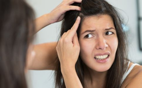 你的发际线后移了吗 发际线后移的原因是什么