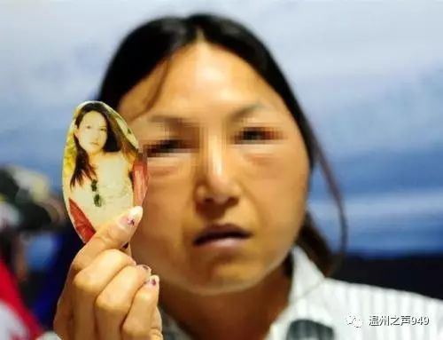 温州一年轻女子整容致右眼失明